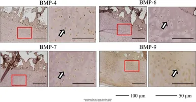 Anti-BMP4 antibody used in IHC (Paraffin sections) (IHC-P). GTX100875