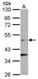 Anti-GCNF antibody [C1C3] used in Western Blot (WB). GTX100883