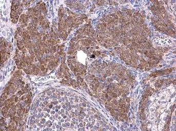 Anti-Cyclin B1 antibody used in IHC (Paraffin sections) (IHC-P). GTX100911