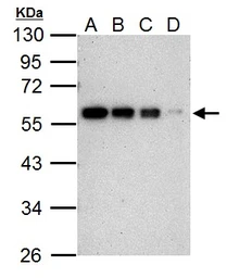 Anti-Cyclin B1 antibody used in Western Blot (WB). GTX100911