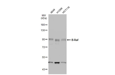 Anti-B-Raf antibody [N2C1], Internal used in Western Blot (WB). GTX100913