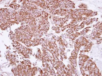 Anti-Angiopoietin 2 antibody used in IHC (Paraffin sections) (IHC-P). GTX100928