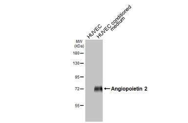 Anti-Angiopoietin 2 antibody used in Western Blot (WB). GTX100928