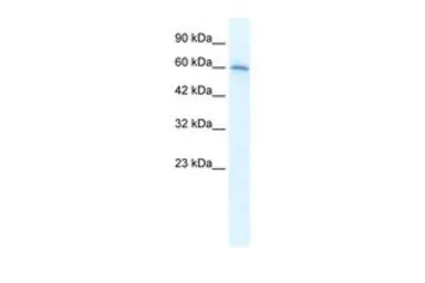 Anti-AChR alpha 7 antibody, Internal used in Western Blot (WB). GTX10096