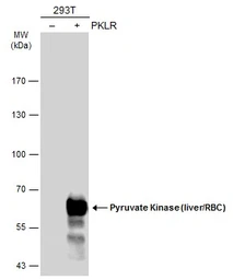 Anti-Pyruvate Kinase (liver/RBC) antibody used in Western Blot (WB). GTX101033