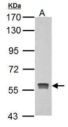 Anti-Pyruvate Kinase (liver/RBC) antibody used in Western Blot (WB). GTX101033