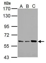 Anti-Pyruvate Kinase (liver/RBC) antibody used in Western Blot (WB). GTX101033