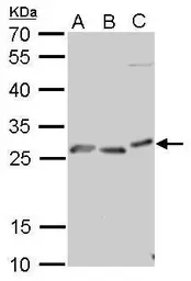 Anti-Prion Protein (PrP) antibody used in Western Blot (WB). GTX101063