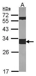 Anti-14-3-3 zeta antibody used in Western Blot (WB). GTX101075
