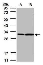 Anti-14-3-3 zeta antibody used in Western Blot (WB). GTX101075