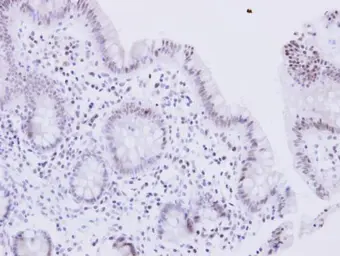 Anti-WRN antibody used in IHC (Paraffin sections) (IHC-P). GTX101081