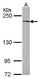 Anti-WRN antibody used in Western Blot (WB). GTX101081