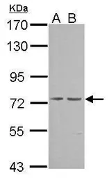 Anti-cGK1 antibody used in Western Blot (WB). GTX101096