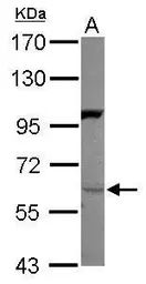 Anti-Neuregulin-1 antibody [C1C3] used in Western Blot (WB). GTX101116