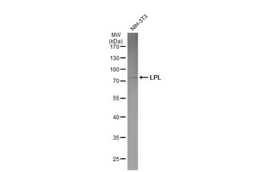 Anti-LPL antibody used in Western Blot (WB). GTX101125