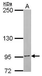 Anti-Insulin Receptor beta antibody used in Western Blot (WB). GTX101136