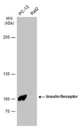 Anti-Insulin Receptor beta antibody used in Western Blot (WB). GTX101136