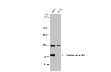 Anti-Insulin Receptor beta antibody used in Western Blot (WB). GTX101136