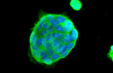 Anti-Insulin Receptor beta antibody used in Immunocytochemistry/ Immunofluorescence (ICC/IF). GTX101136