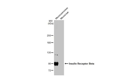 Anti-Insulin Receptor beta antibody used in Western Blot (WB). GTX101136