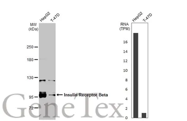 Anti-Insulin Receptor beta antibody used in Western Blot (WB). GTX101136