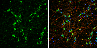 Anti-NF-L antibody used in Immunocytochemistry/ Immunofluorescence (ICC/IF). GTX101142