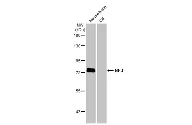 Anti-NF-L antibody used in Western Blot (WB). GTX101142