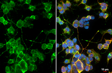 Anti-NF-L antibody used in Immunocytochemistry/ Immunofluorescence (ICC/IF). GTX101142