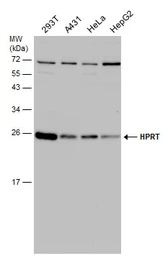 Anti-HPRT antibody used in Western Blot (WB). GTX101148