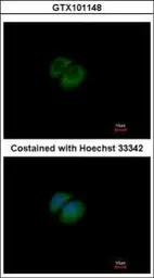 Anti-HPRT antibody used in Immunocytochemistry/ Immunofluorescence (ICC/IF). GTX101148