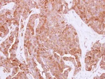 Anti-HPRT antibody used in IHC (Paraffin sections) (IHC-P). GTX101148