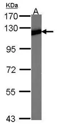 Anti-NFkB p100 antibody [C2C3], C-term used in Western Blot (WB). GTX101150