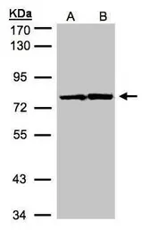 Anti-HADHA antibody used in Western Blot (WB). GTX101177