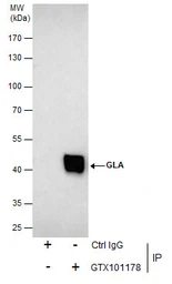 Anti-Galactosidase alpha antibody [N1C2] used in Immunoprecipitation (IP). GTX101178
