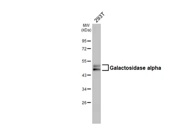 Anti-Galactosidase alpha antibody [N1C2] used in Western Blot (WB). GTX101178