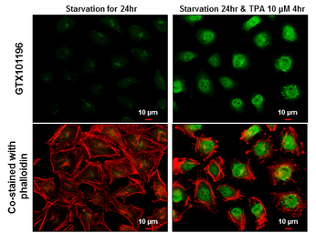 Anti-c-Fos antibody used in Immunocytochemistry/ Immunofluorescence (ICC/IF). GTX101196