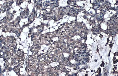 Anti-GGT1 antibody used in IHC (Paraffin sections) (IHC-P). GTX101198