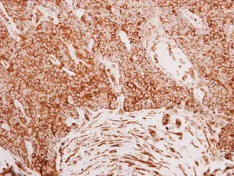 Anti-Filamin B antibody [N1], N-term used in IHC (Paraffin sections) (IHC-P). GTX101206