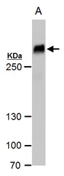 Anti-Filamin B antibody [N1], N-term used in Western Blot (WB). GTX101206