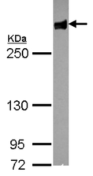 Anti-Filamin B antibody [N1], N-term used in Western Blot (WB). GTX101206