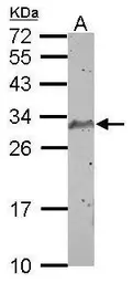 Anti-SCP3 antibody used in Western Blot (WB). GTX101207