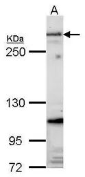 Anti-Fibrillin 1 antibody [C3], C-term used in Western Blot (WB). GTX101216