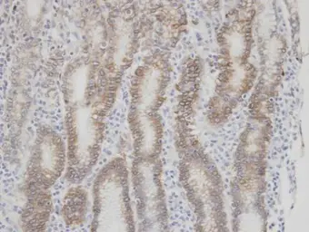 Anti-Factor VII antibody [N3C3] used in IHC (Paraffin sections) (IHC-P). GTX101238