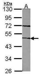 Anti-Factor VII antibody [N3C3] used in Western Blot (WB). GTX101238