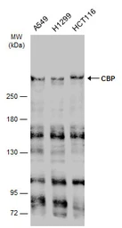 Anti-CBP antibody [C3], C-term used in Western Blot (WB). GTX101249