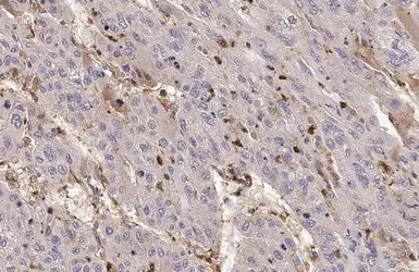 Anti-C Reactive Protein antibody [N1C3] used in IHC (Paraffin sections) (IHC-P). GTX101262