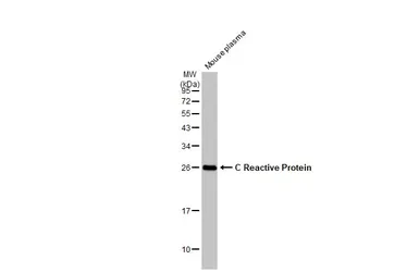 Anti-C Reactive Protein antibody [N1C3] used in Western Blot (WB). GTX101262