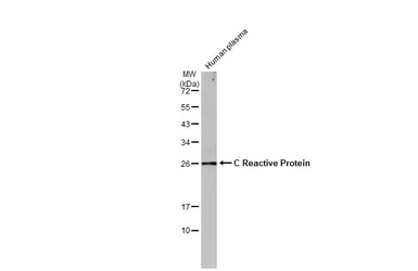 Anti-C Reactive Protein antibody [N1C3] used in Western Blot (WB). GTX101262