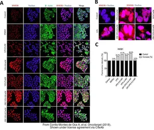 Anti-HMGB1 antibody used in Immunocytochemistry/ Immunofluorescence (ICC/IF). GTX101277