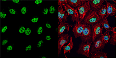 Anti-HMGB1 antibody used in Immunocytochemistry/ Immunofluorescence (ICC/IF). GTX101277